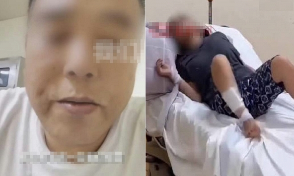 Người đàn ông bị chó cắn 47 ngày rồi qua đời: Bác sĩ nhắc điều phải làm ngay khi có vết thương