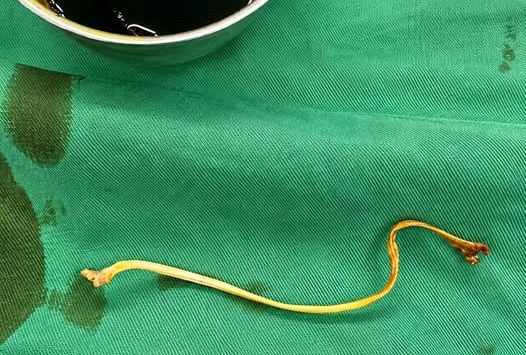Chia sẻ của BS Nguyễn Ngọc Tú khiến nhiều người mẹ nghẹn lòng: Dù đã khâu cổ tử cung nhưng vẫn chẳng thể giữ được con...