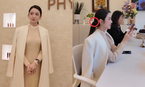 “Cơ địa” gây bàn tán của Chu Thanh Huyền