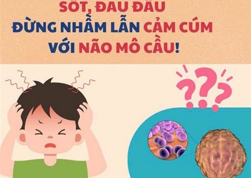 Cúm mùa và não mô cầu đều có thể gây sốt cao đột ngột: Bác sĩ Trương Hữu Khanh chỉ cách phân biệt 2 bệnh