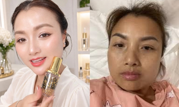 Quỳnh Trần JP bị tố quảng cáo serum quá lố vì màn ghép mặt xài app và mặt mộc: Động thái gây chú ý