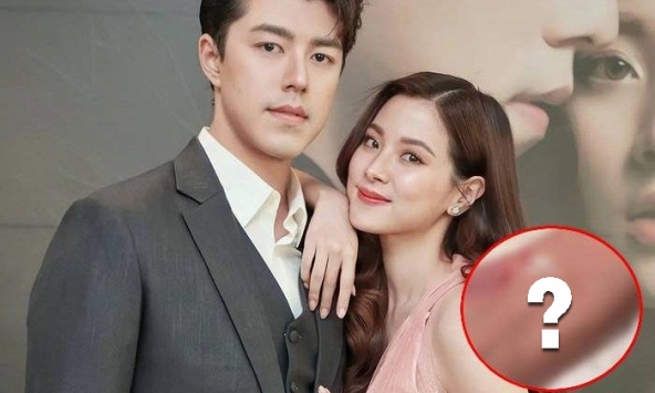 Tình trạng thê thảm của Baifern sau khi bị ép chia tay Nine Naphat