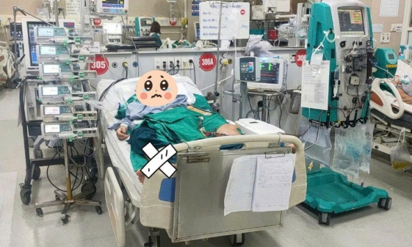Kỳ tích y học Việt Nam: Cứu sống nữ sinh 17 tuổi mắc căn bệnh khiến thận ngừng hoạt động, phổi ngập máu, thế giới mới ghi nhận 600 ca