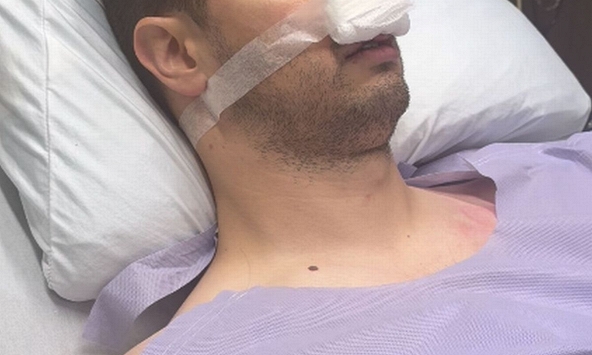 Tỉnh dậy sau phẫu thuật, người đàn ông Mỹ bỗng nhiên nói tiếng Tây Ban Nha trôi chảy dù trước đó chỉ biết đếm đến 10  