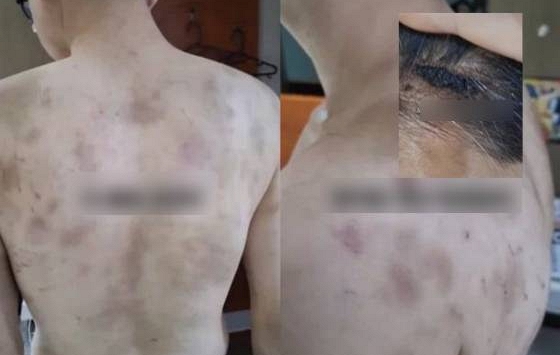 Rúng động Hàn Quốc: Nam nhân viên bị chủ quán hành hạ, ép làm việc 20 giờ/ngày, camera giám sát 24/7