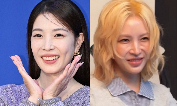 Nữ hoàng Kpop không còn trẻ đẹp?