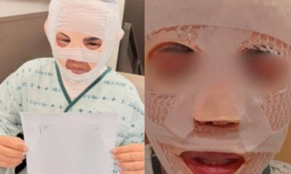 Chồng đổ nước sôi lên mặt vợ đang ngủ vì sợ vợ quen người đàn ông khác