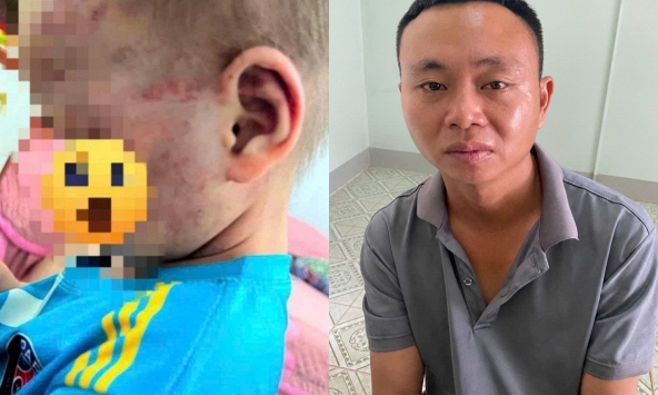Tạm giữ hình sự cha dượng Nguyễn Hữu Nam SN 1993