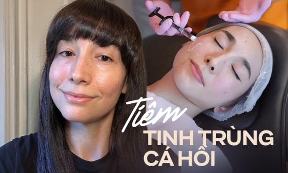 Sử dụng tinh trùng cá hồi vì muốn đẹp như sao Hollywood, tôi tự hỏi tại sao mình không tìm đến phương pháp trẻ hóa da này sớm hơn