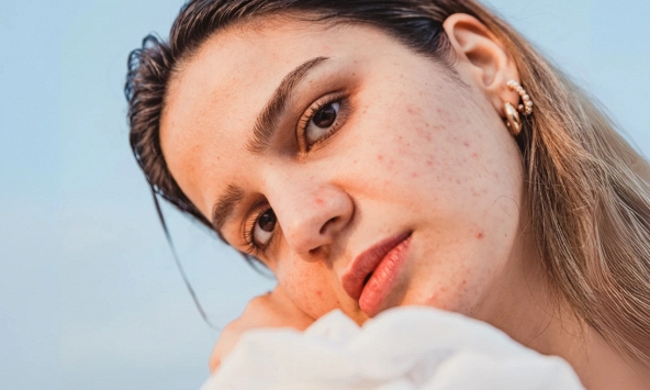 4 thay đổi không ngờ này ở ngoại hình của bạn có thể do hormone tác động phía sau, rõ nhất là ở làn da và mái tóc