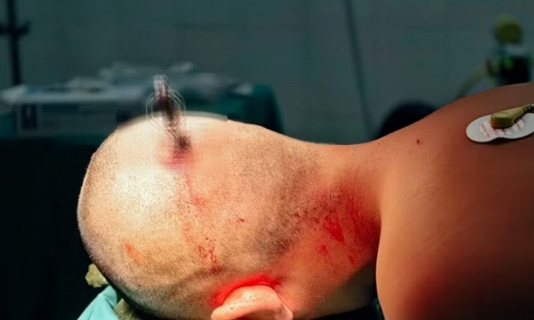 Tôi bàng hoàng khi đọc bài CẢNH BÁO từ Bệnh viện Việt Đức: Có những trò đùa của học sinh, còn dung túng sẽ gây hậu quả khôn lường!