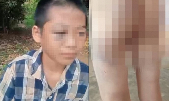 Chi tiết cực đắt trong vụ bé lớp 6 nghi bị mẹ kế và cha bạo hành: Chúng ta cần nhìn lại để dạy con mình!