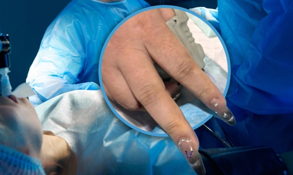 Cô gái nguy kịch khi nhập viện cấp cứu nhưng không thể lắp máy hỗ trợ vì bộ móng úp