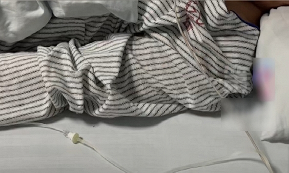 Chàng trai 30 tuổi mắt phải bỗng bị mờ, đi khám bác sĩ kết luận: Hệ miễn dịch đã bị tổn hại hoàn toàn