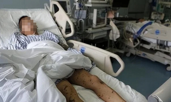 Người đàn ông suy thận vì mắc 1 sai lầm khi làm 'chuyện ấy'