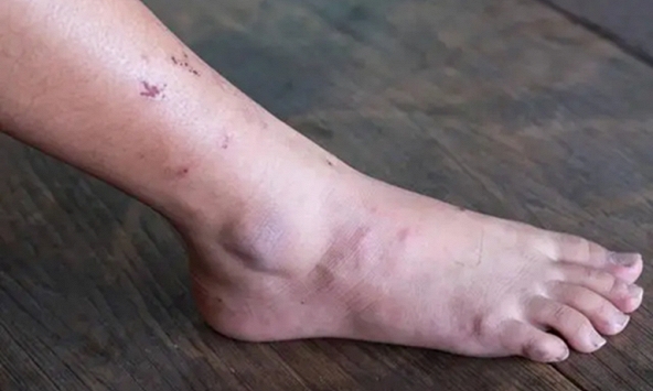 Khi ung thư mới bắt đầu hình thành, người ta thường cảm thấy 3 điều không ổn, nhưng ít ai chú ý đến