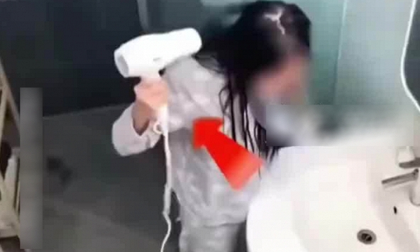 Sấy tóc sau khi gội đầu, cô gái bỏng thâm đen bàn tay: Thói quen ai cũng đã từng mắc phải