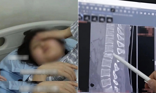 Dùng điện thoại khi làm 1 việc, cô gái có thể liệt 2 chân, tiểu không tự chủ suốt đời