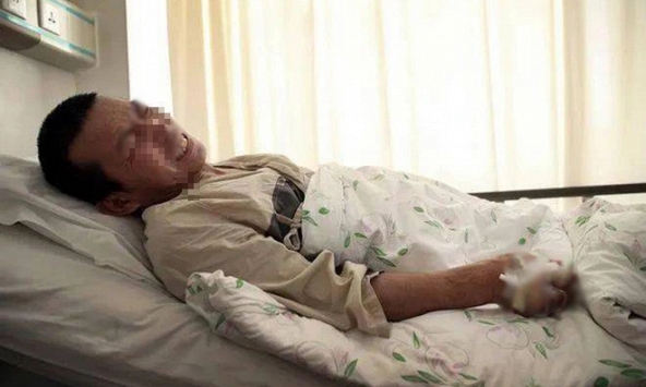 Người đàn ông phải cắt cụt ngón trỏ vì ung thư sau 3 tháng xem nhẹ 1 thứ