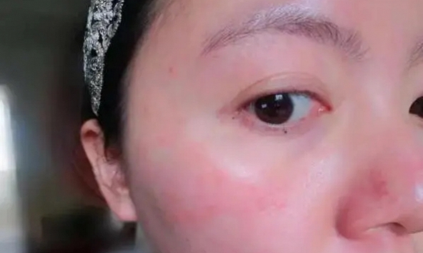 6 dấu hiệu trên khuôn mặt tiết lộ sức khỏe của bạn