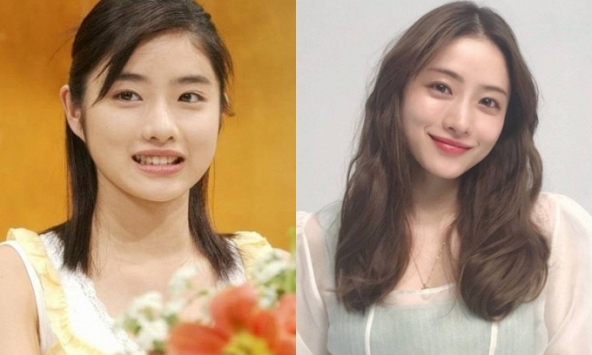 4 thói quen khiến khuôn mặt ngày càng to tròn, cái đầu nhiều người mắc nhất