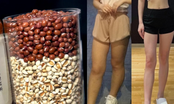 7 loại thực phẩm giúp loại bỏ phù nề, luôn có sẵn ở chợ Việt