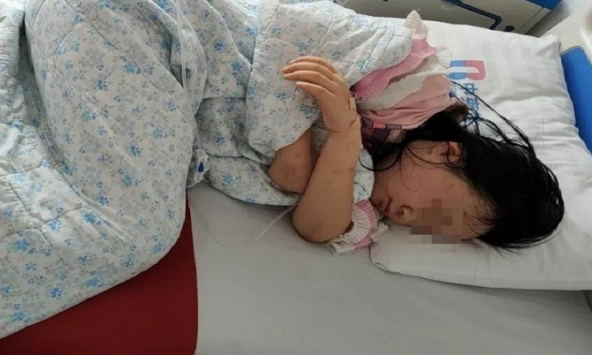 Cô gái 17 tuổi ngộ độc nặng, phải 'rửa dạ dày' vì món ăn quen thuộc này