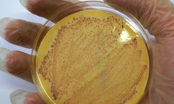 Cô gái 29 tuổi vốn khỏe mạnh tử vong 10 ngày sau khi nhiễm siêu vi khuẩn 'đục lỗ phổi'