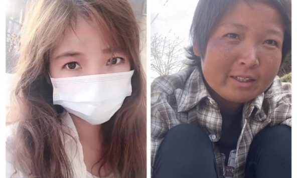 Cô gái 28 tuổi 'phượt' chục nghìn cây số 3 năm khiến gương mặt từ thiếu nữ thành 'bà thím', bác sĩ chỉ ra nguyên nhân bất ngờ