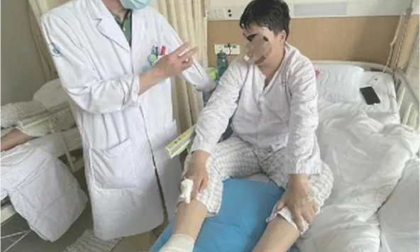 Chân nam sinh mọc đầy cục tròn cứng như đá, không thể đi lại vì uống thứ này thay nước