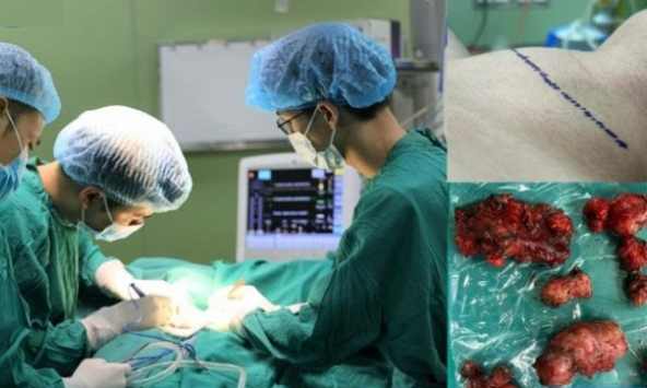 Vĩnh Phúc: Chàng trai phải cắt bỏ toàn bộ tuyến giáp vì ung thư sau khi có 2 dấu hiệu phổ biến nhiều người bỏ lỡ