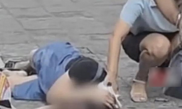 Chỉ sau 1 đêm, cô gái đang khỏe mạnh bỗng thành người thực vật vì thứ nữ giới hay đeo lên tóc