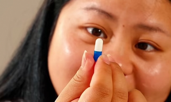 Rùng mình: Nuốt 'trứng sán' để giảm cân, cô gái 21 tuổi bị giun ký sinh, tổn thương 3 cơ quan 