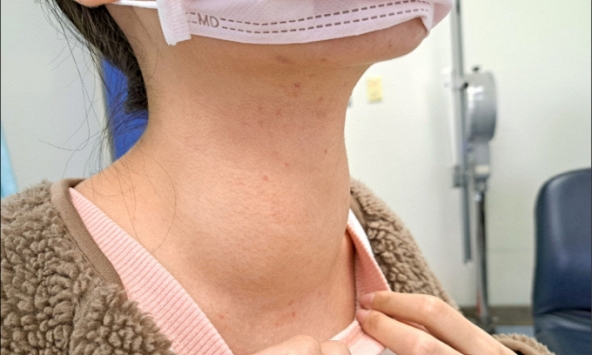 4 thực phẩm vốn tốt nhưng ăn quá nhiều tuyến giáp không chịu nổi, sớm muộn gì cũng bệnh