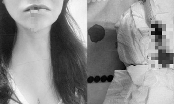 Người phụ nữ ho ra máu vì 1 vật dụng quen thuộc trong nhà tắm ngày nào cũng dùng tới