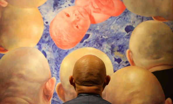 Tình trạng hói đầu ở nam thanh niên châu Á đang gia tăng mức báo động