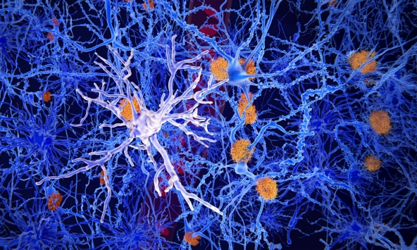 Các nhà khoa học tìm thấy nhóm tế bào não có thể ngăn chặn bệnh Alzheimer