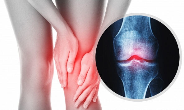 Bước đột phá trong nghiên cứu phục hồi khớp lão hóa, mở ra triển vọng cho điều trị thoái hóa khớp