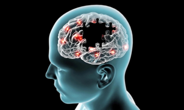 Giải mã mắt xích protein then chốt thúc đẩy sự tiến triển của bệnh Parkinson