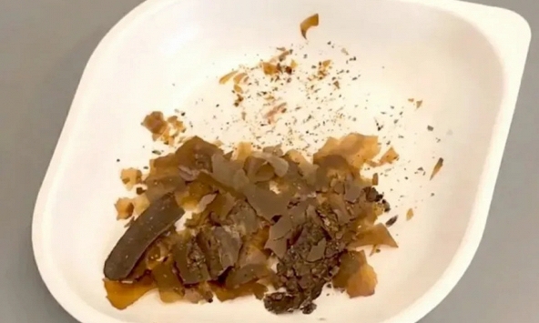 Phát hiện khảo cổ hé lộ cách chữa bệnh kỳ lạ của người La Mã cổ đại