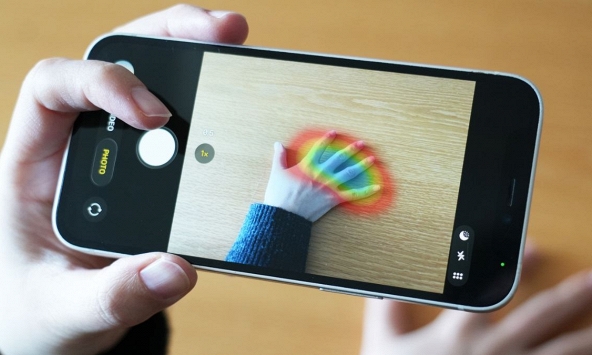 Mô hình AI chẩn đoán chính xác bệnh hiếm chỉ qua hình ảnh bàn tay