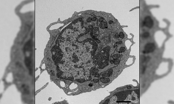 Phát hiện protein có thể nắm giữ chìa khóa giúp làm chậm quá trình lão hóa từ gốc