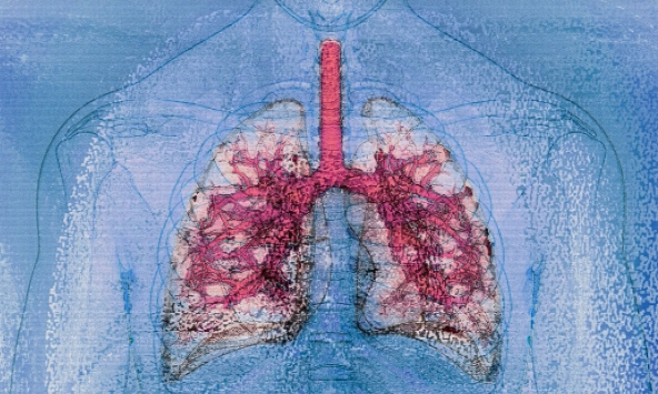 Mỹ thực hiện thành công ca ghép đa tạng từ người nhiễm HIV sang người nhiễm HIV đầu tiên trên thế giới