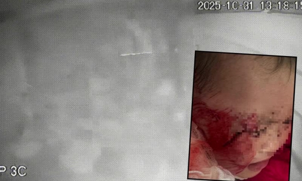 Kinh hoàng giây phút sập trần thạch cao tại 1 trường Mầm non ở Nghệ An: Mảng trần lớn rơi đúng khu vực ngủ, đè trúng 3 trẻ