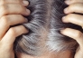 Mỗi sợi tóc bạc có thể là dấu hiệu cơ thể tự bảo vệ khỏi ung thư